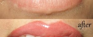 Татуаж губ: сравнение до и после процедуры